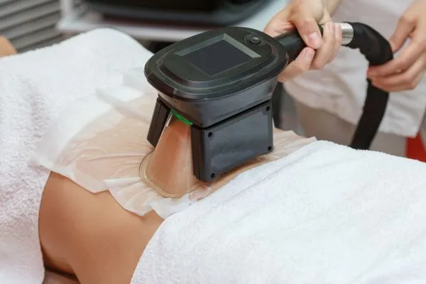 Image of person having fat freezing treatment to help weight gain Beccles
