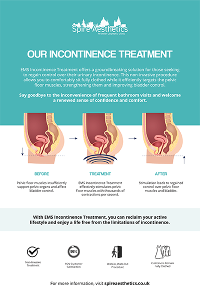 image of how urge incontinence Beccles treatment works